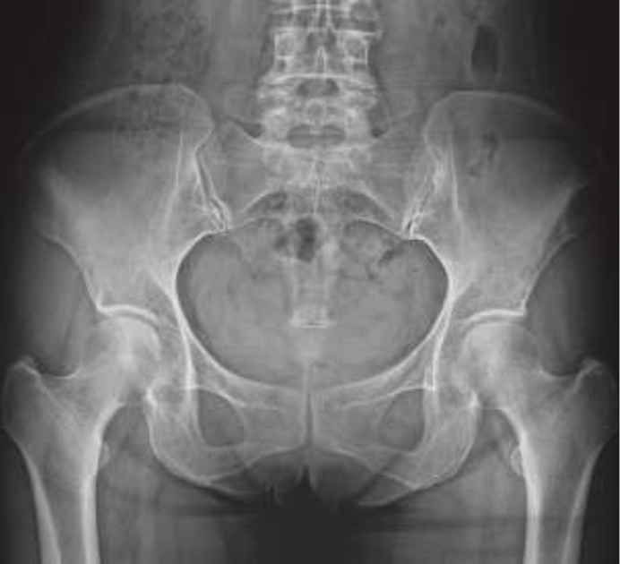 Sin%20título%20%286.7%20×%208.6 cm%29%20%286.7%20×%206.1 cm%29